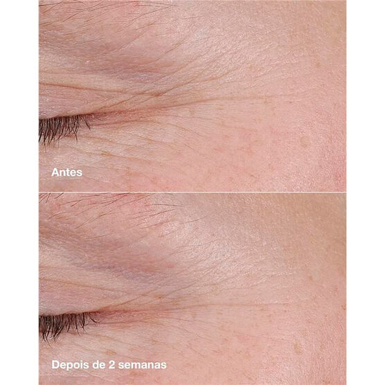 Balm Pro Idade Clinique Smart™ Retinóide